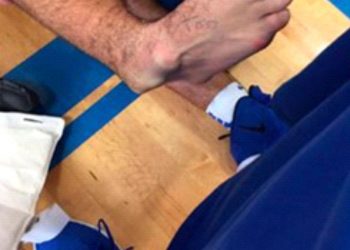 SUFRE FRACTURA DE TIBIA Y PERONÉ