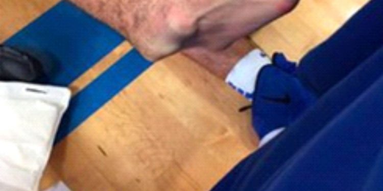 SUFRE FRACTURA DE TIBIA Y PERONÉ