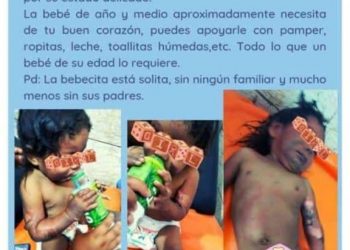 NIÑA CON QUEMADURAS FUE ABANDONADA