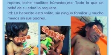 NIÑA CON QUEMADURAS FUE ABANDONADA