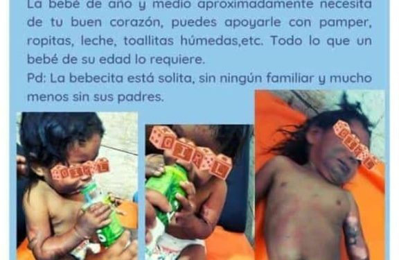 NIÑA CON QUEMADURAS FUE ABANDONADA