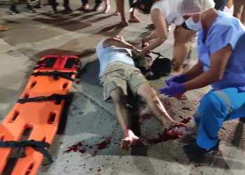 DESTROZA PIERNA A MOTOCICLISTA