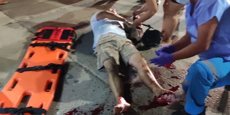 DESTROZA PIERNA A MOTOCICLISTA