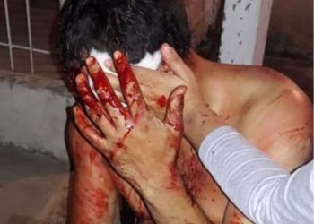 LO APUÑALAN EN LA CABEZA