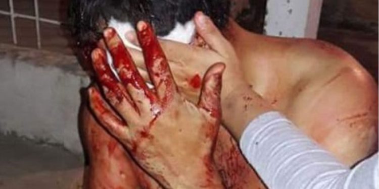 LO APUÑALAN EN LA CABEZA