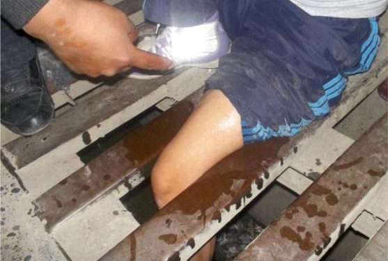 LIBERAN PIERNA  DE MUJER  ATRAPADA EN  REJILLA DE  CUNETA DE  AGUAS PLUVIALES