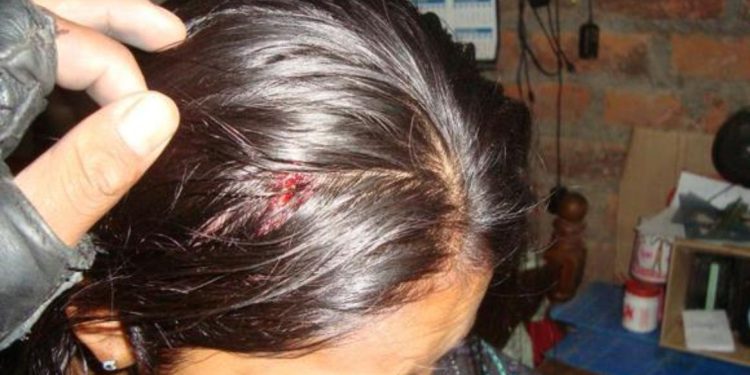 SUJETO EBRIO AGREDE  A SU HERMANA